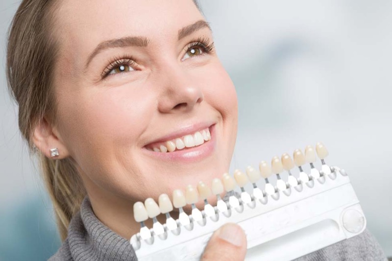 Smiling patient beside a shade guide used to choose the tooth colour
